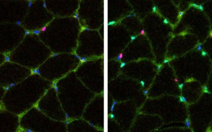 Introduction of Yamanaka factors into myofibers increases the number of myogenic progenitors. Left: Control. Right: Treatment Tuesday, 25/05/2021 - 09:54