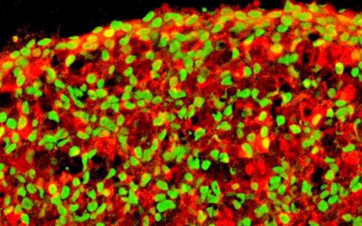 Pancreatic beta cells derived from human iPS cells. In red: insulin. In green: NKX6.1 cells Monday, 07/06/2021 - 09:31