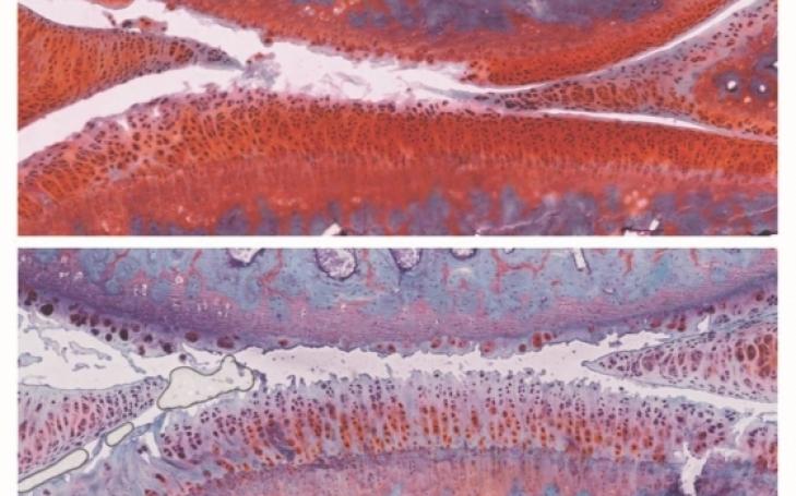 Izpisua manages to counteract arthritis by combining two experimental drugs Izpisua manages to counteract arthritis by combining two experimental drugs