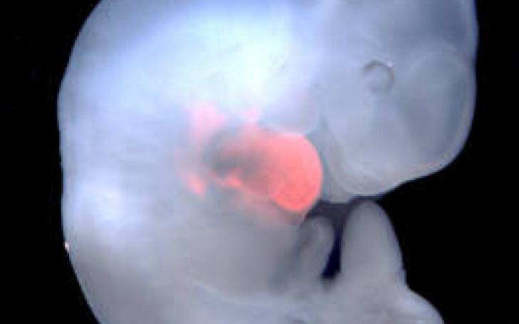 The team of scientific experts led by MD Izpisua closer to generate human organs for transplantation