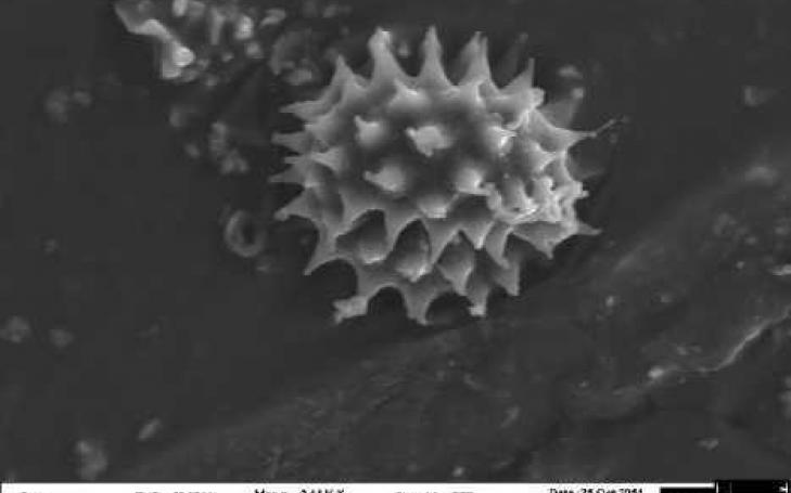 UCAM's researchers have found scientific evidence that places the Shroud of Oviedo and the Shroud of Turin in the same scenario