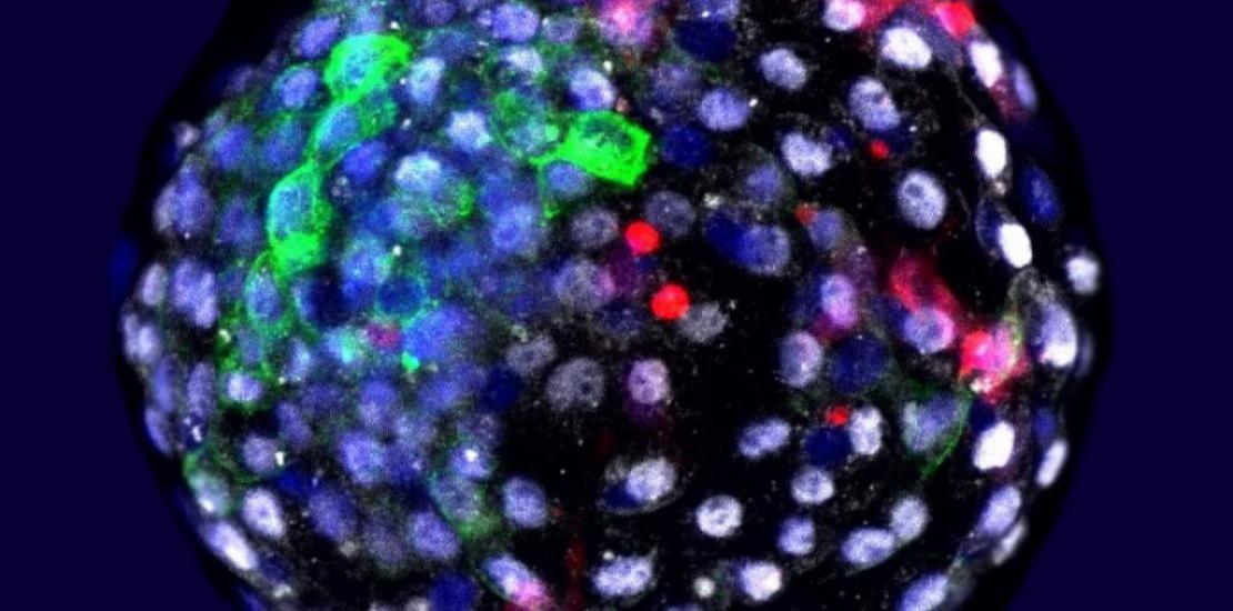 Fluorescence visualization of cells of different species at an early embryonic stage. In red, human cells. Author: Weizhi Ji, Kunming University of Science and Technology