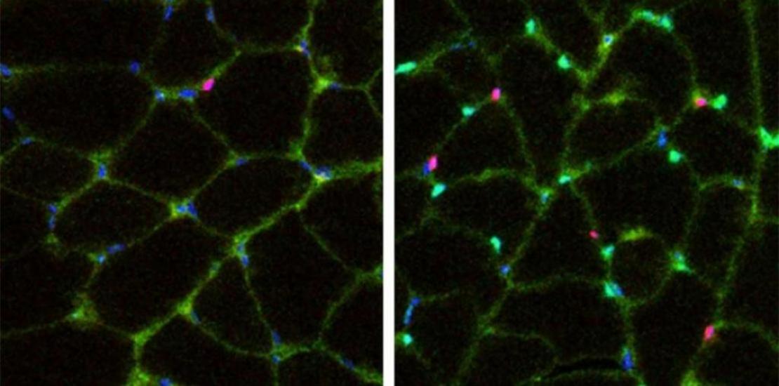 Introduction of Yamanaka factors into myofibers increases the number of myogenic progenitors. Left: Control. Right: Treatment Tuesday, 25/05/2021 - 09:54
