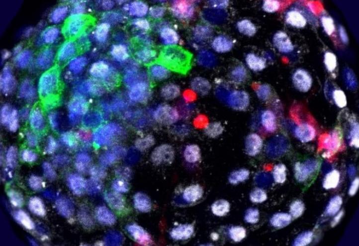 Fluorescence visualization of cells of different species at an early embryonic stage. In red, human cells. Author: Weizhi Ji, Kunming University of Science and Technology