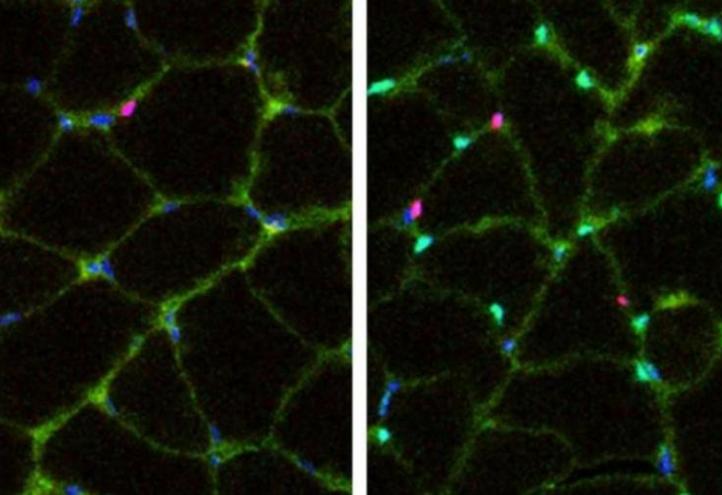 Introduction of Yamanaka factors into myofibers increases the number of myogenic progenitors. Left: Control. Right: Treatment Tuesday, 25/05/2021 - 09:54