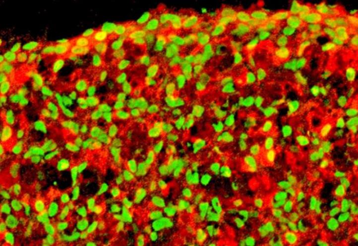Pancreatic beta cells derived from human iPS cells. In red: insulin. In green: NKX6.1 cells Monday, 07/06/2021 - 09:31