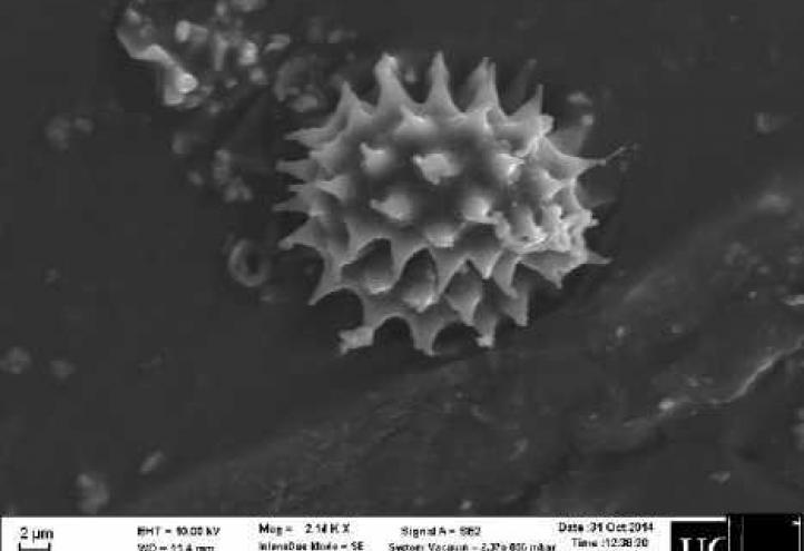 UCAM&#039;s researchers have found scientific evidence that places the Shroud of Oviedo and the Shroud of Turin in the same scenario